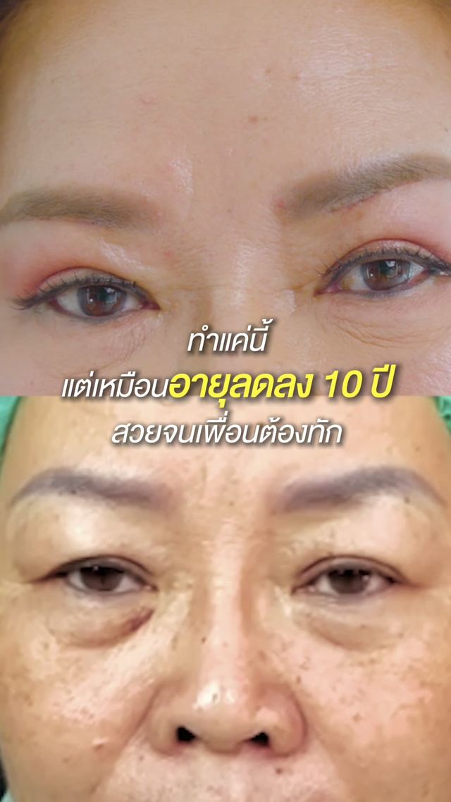 วิดีโอรีวิวจากผู้รับบริการ MADAM Medical Clinic